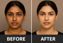 Photo of गर्मियों में धूप से जली और बेजान त्वचा के लिए एलोवेरा है एक कारगर घरेलू उपाय